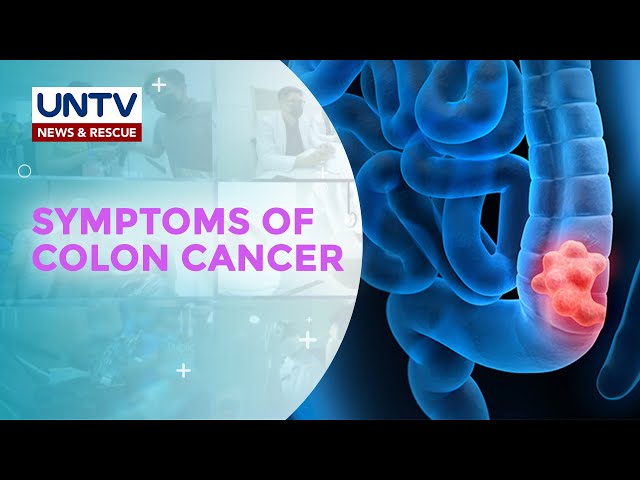 ⁣Ano ang mga senyales o simtomas ng isang taong may colon cancer?