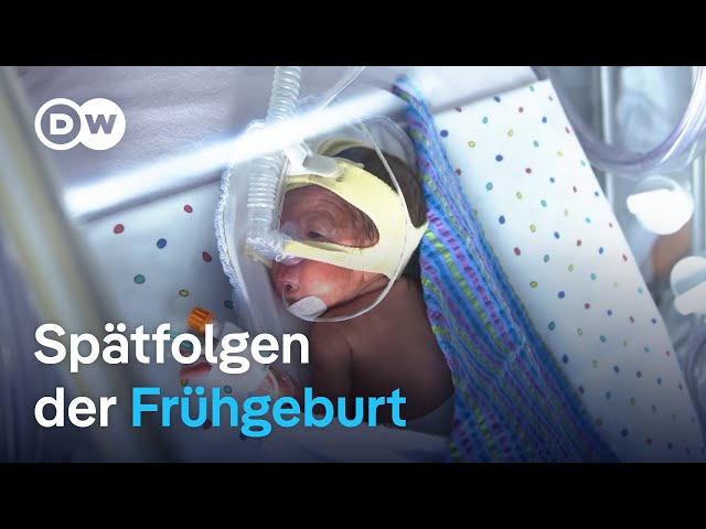 ⁣Früh geboren, für immer spät dran? | DW Reporter