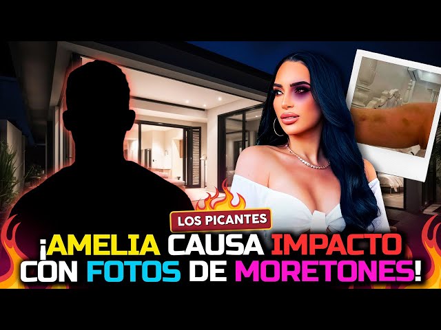 ⁣Amelia Alcántara en la Mira: Foto con Moretones Desata controversia en Redes | Vive el Espectáculo