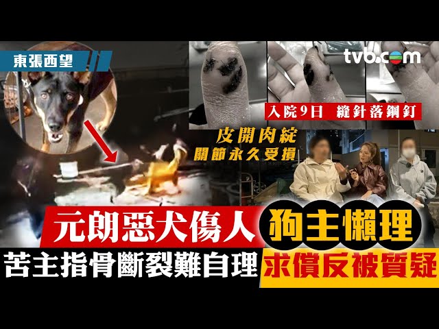 ⁣東張西望｜元朗惡犬傷人狗主懶理 苦主指骨斷裂難自理 求償反被質疑