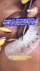 ⁣Allergies, démangeaisons: des ophtalmologues alertent sur la pose d’extensions de cils mal réalisées