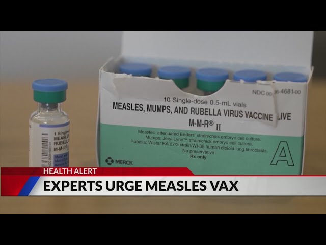 ⁣Experts urge people to get measles vaccine