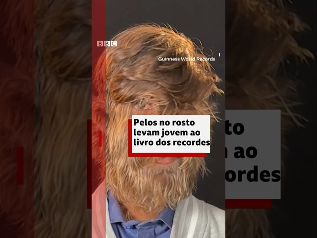 ⁣Guinness: adolescente entra no livro dos recordes por causa dos pelos faciais #bbcnewsbrasil