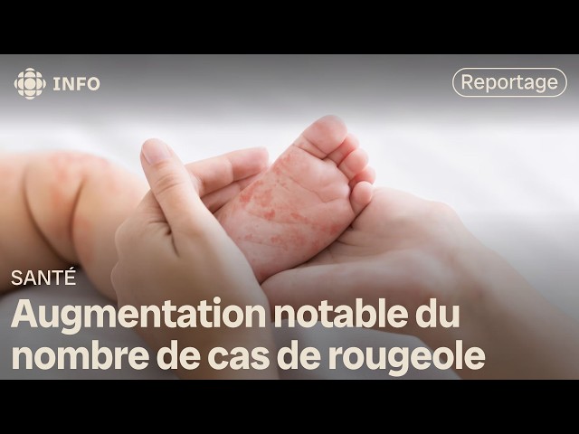 ⁣Vaccination contre la rougeole : un recul au Québec depuis la pandémie