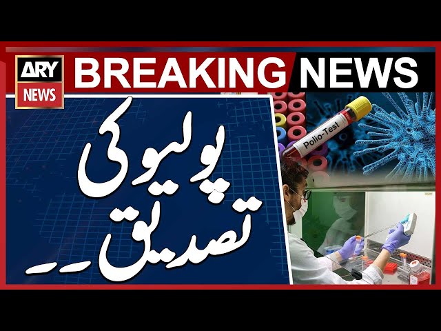 ⁣Polio Confirmed in Samples from 12 Districts