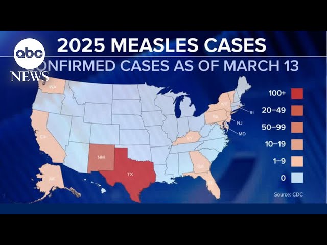 ⁣Measles cases grow as RFK Jr. makes controversial claims about treatment