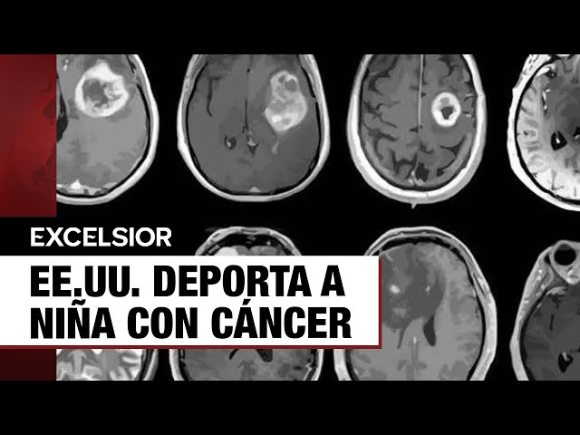 ⁣EE.UU. deporta a niña con cáncer cerebral; viajaba por tratamiento